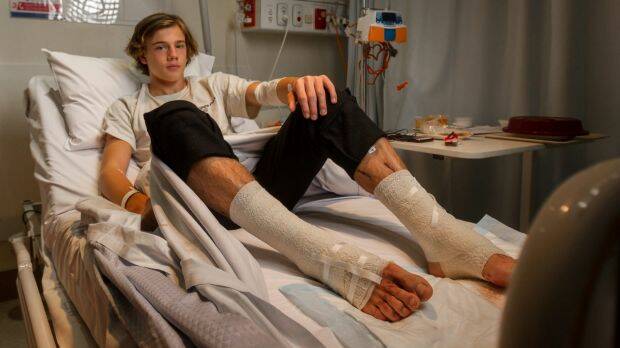 Sam Kanizay, 16, was bitten by some sort of critter at Brighton Beach while soaking his legs after a footy match. Photo: Scott McNaughton
