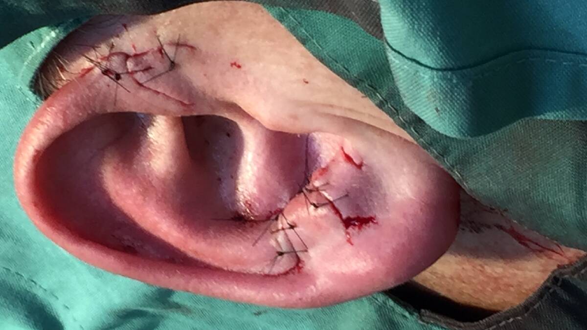 A total of 12 stitches were required to repair the ripped ear.