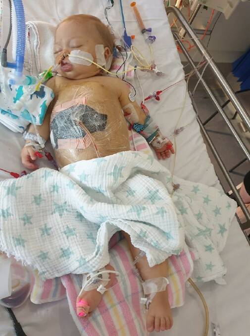 LONG ROAD AHEAD: Nine and a half month old Isaac after undergoing a liver transplant last week.
