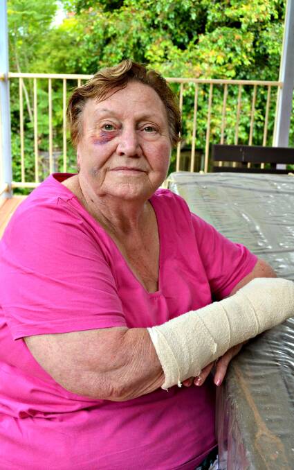 HAZARD: Gail Lee Wheatley suffered bruising and a broken finger after tripping on loose pavers at the northern end of Kinghorne Street recently.