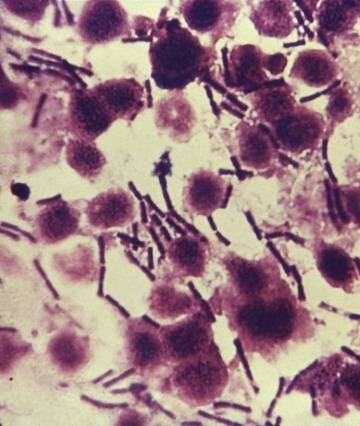 US authorities have discovered part of a batch of anthrax was sent to Australia in 2008.