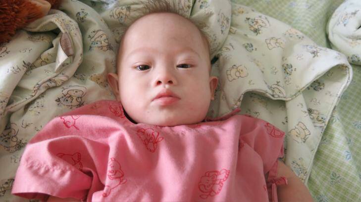 Pattharamon Janua's baby son Gammy on Sunday in a Thailand hospital Photo: Am Sandford