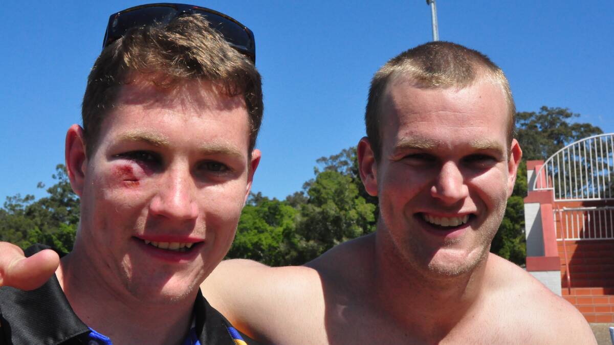 Sporting a shiner from the Nowra-Bomaderry Jets victory in the Group 7 premiership on Sunday is Jets player Matt Rouen from Nowra with teammate James Toovey from Culburra.