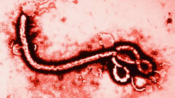 Federal Health Dept laughs off Ebola concerns