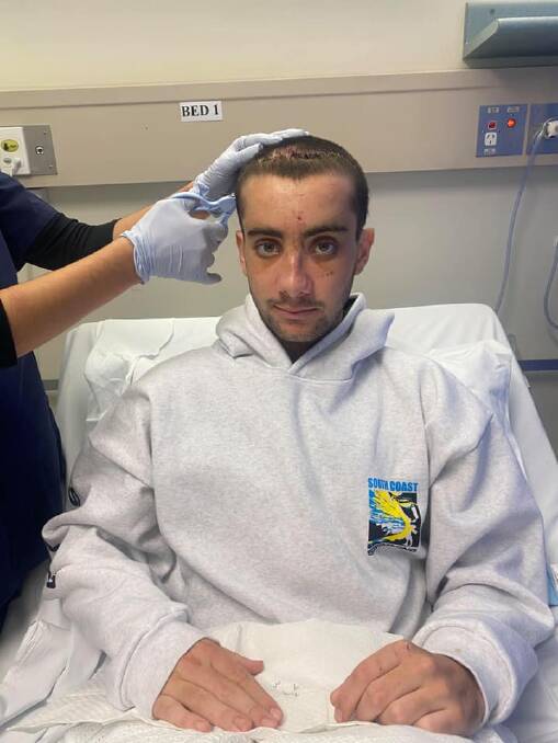 Jack gets the staples removed from his head. Photo: Supplied