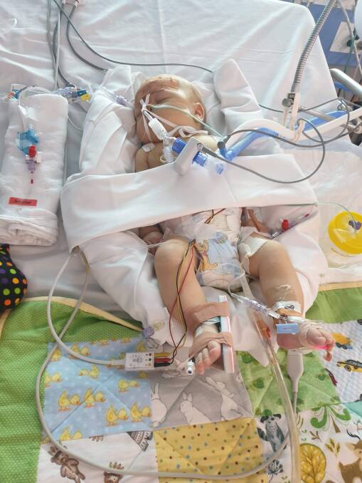 Isaac at seven weeks after undergoing surgery at the Randwick Childrens Hospital. Photo: Supplied
