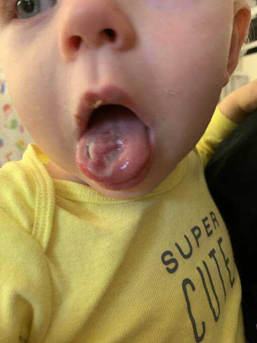 Oscar suffered horrific burns to his palate, lips and tongue after being electrocuted. Photo: Supplied/Claire Karlson