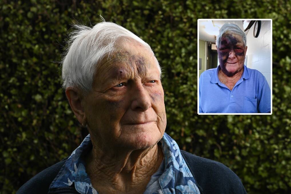 GRATEFUL: Charlie Caldwell of Wodonga says he's lucky he has neighbours to look out for him as his family can't visit from Melbourne. Right: Mr Caldwell in hospital after his fall. Picture: MARK JESSER 
