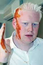 HOLD THE SAUCE: This is how Councillor Gareth Ward looked after his lunchtime altercation with Cr Willmott.
