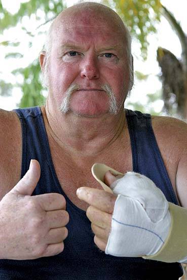 GAMBLE: Geoff McLaren took a calculated risk when he had a toe amputated and grafted to his hand after losing his thumb.